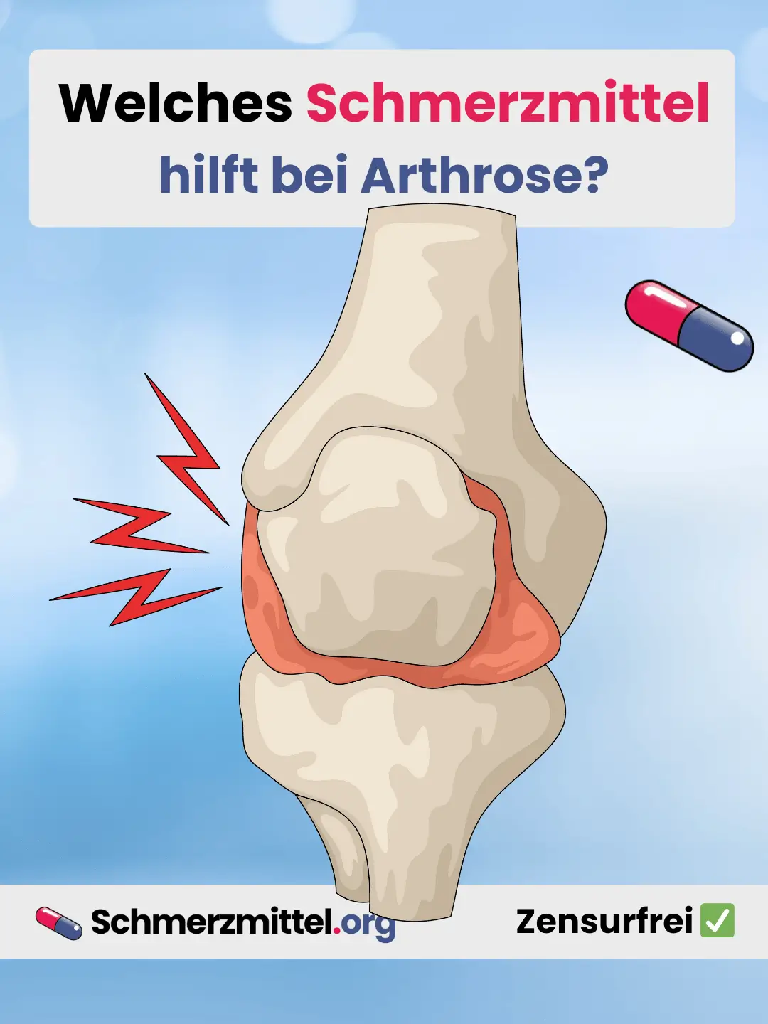 Welches Schmerzmittel bei Arthrose Teilen
