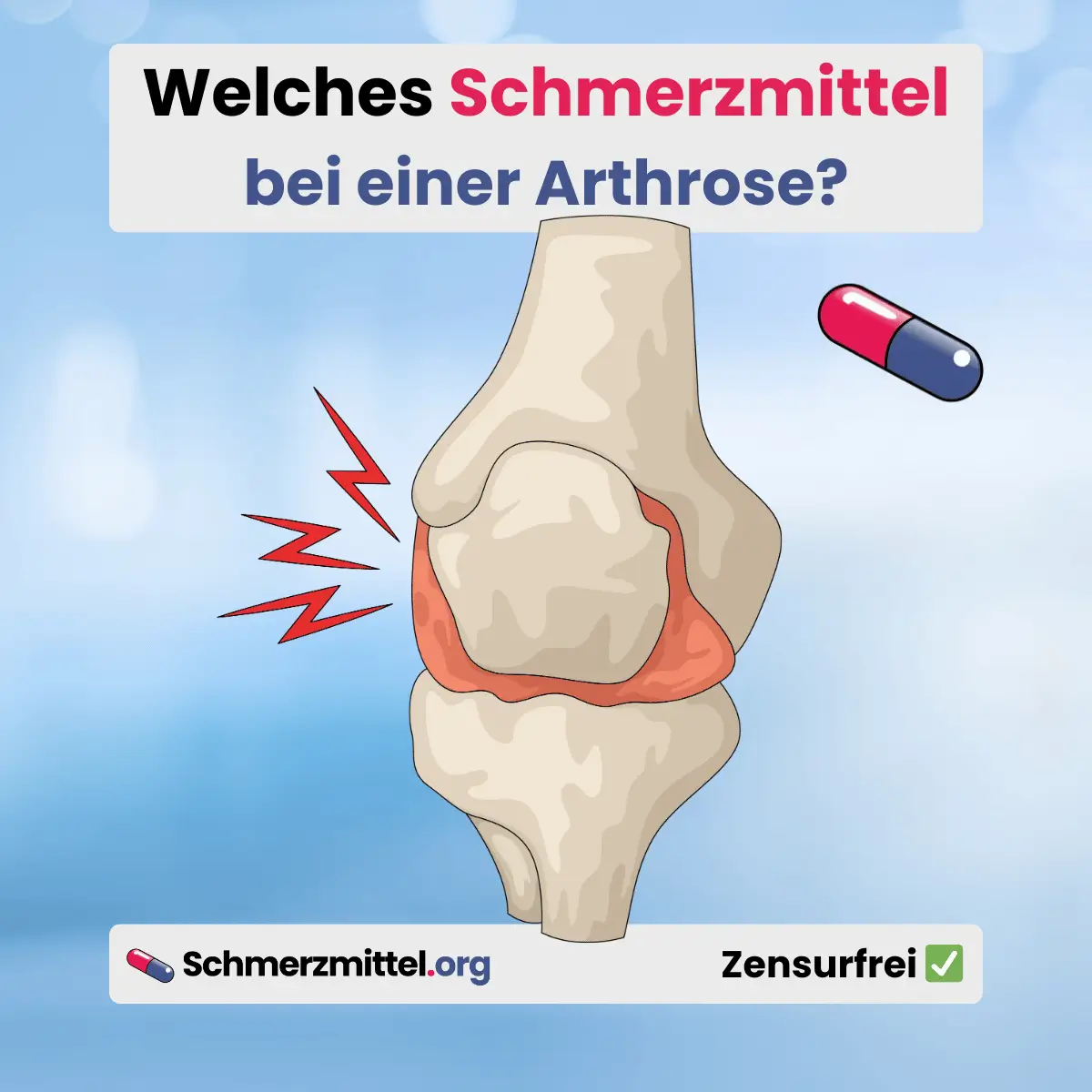 Welches Schmerzmittel bei Arthrose
