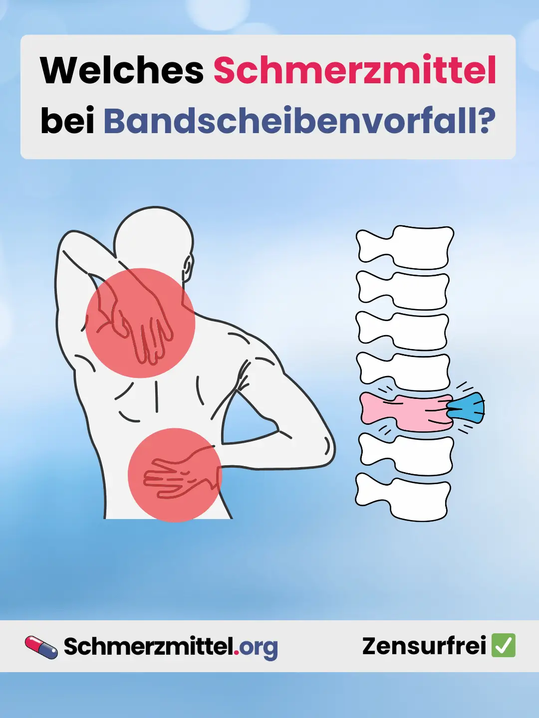 Welches Schmerzmittel bei Bandscheibenvorfall Teilen