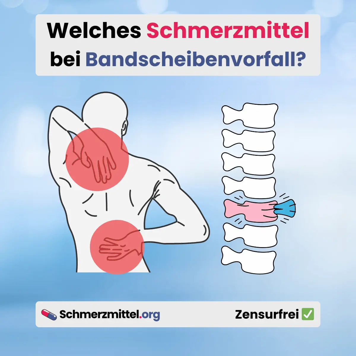 Welches Schmerzmittel bei Bandscheibenvorfall