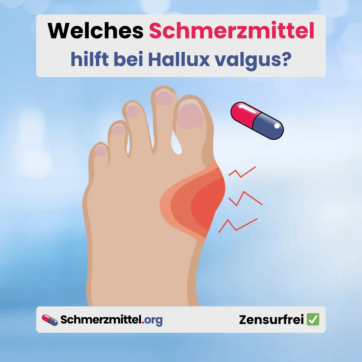 Welches Schmerzmittel bei Hallux valgus