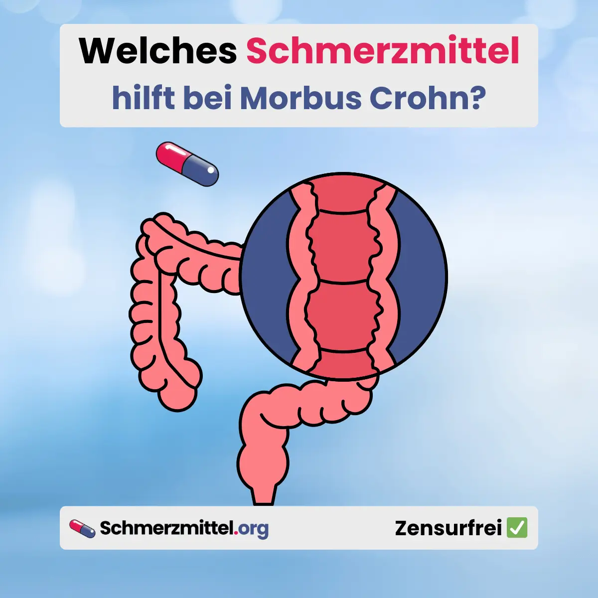 Welches Schmerzmittel bei Morbus Crohn
