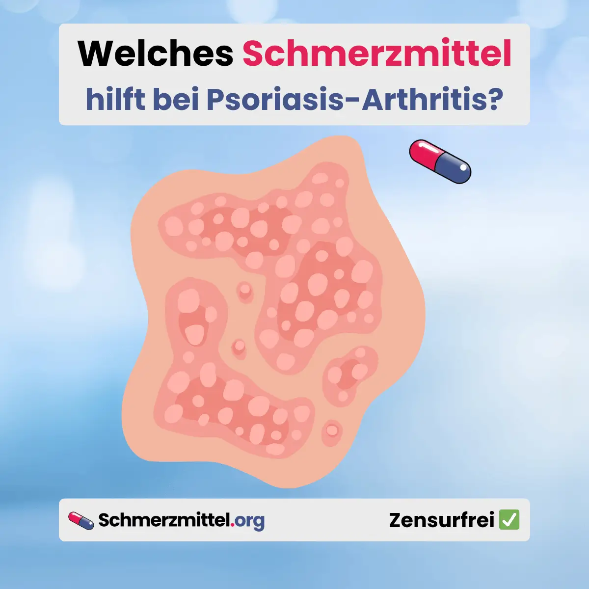 Welches Schmerzmittel bei Psoriasis-Arthritis