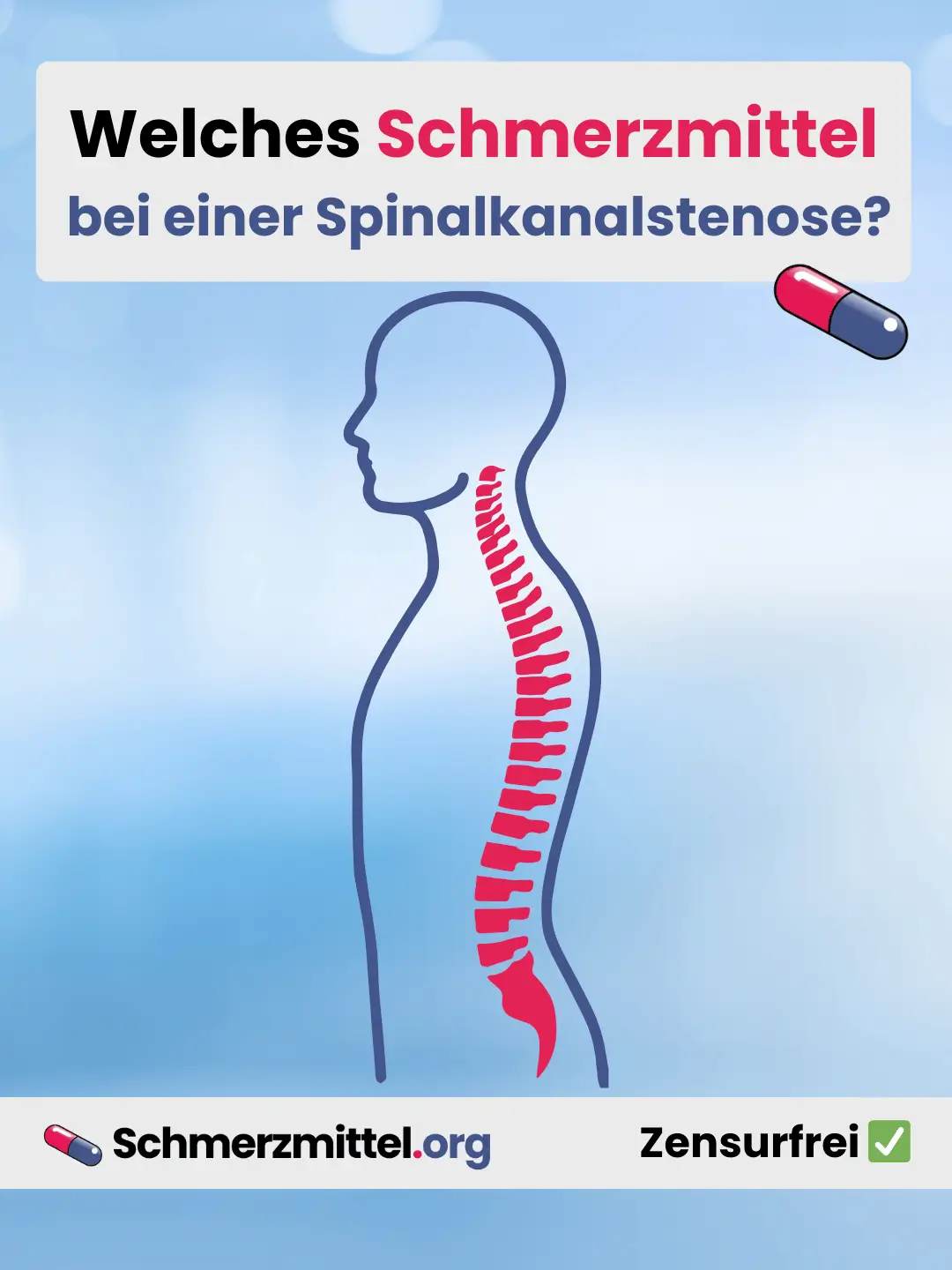 Welches Schmerzmittel bei Spinalkanalstenose Teilen
