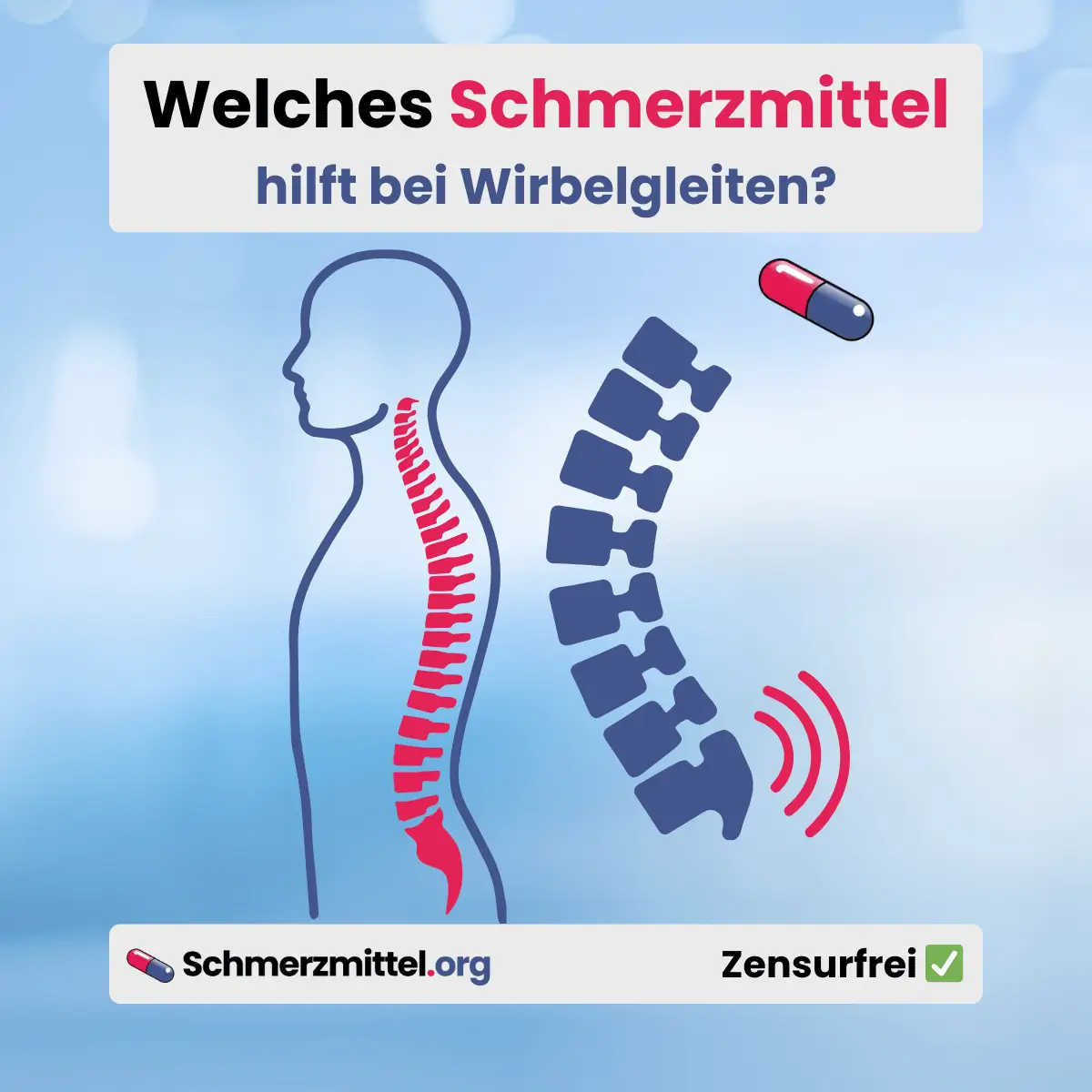 Welches Schmerzmittel bei Wirbelgleiten