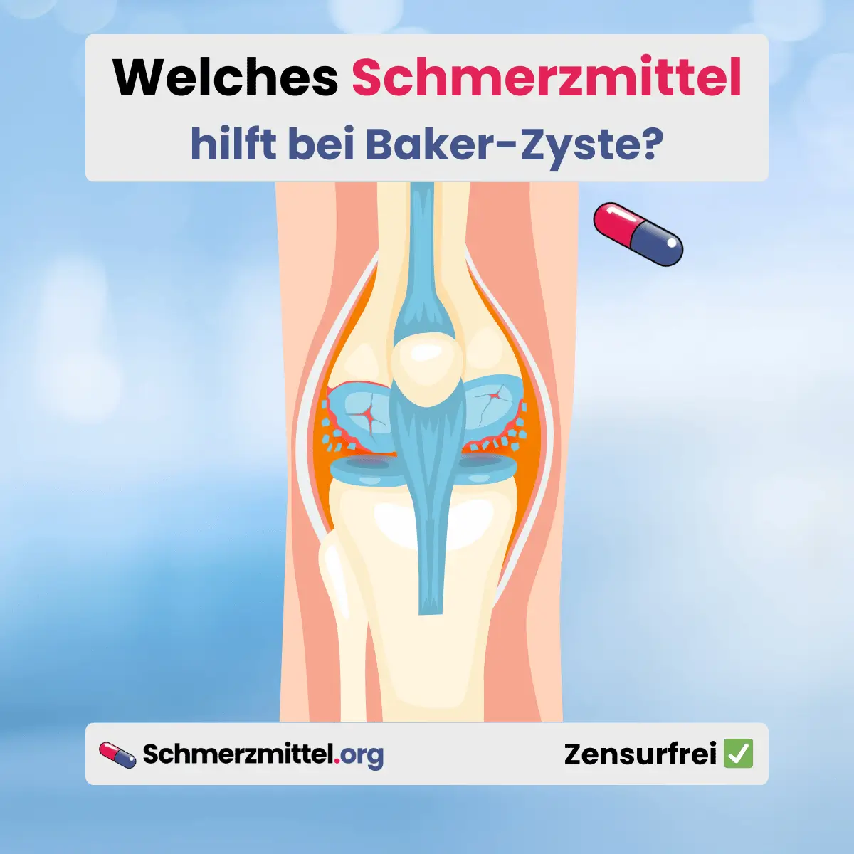 Welches Schmerzmittel bei baker zyste hilfe