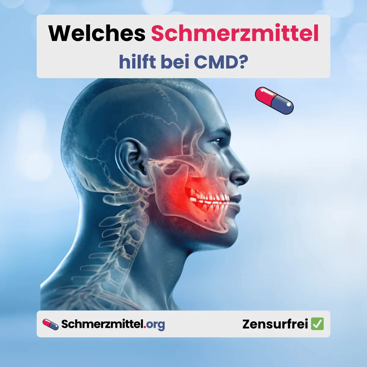Welches Schmerzmittel bei cmd