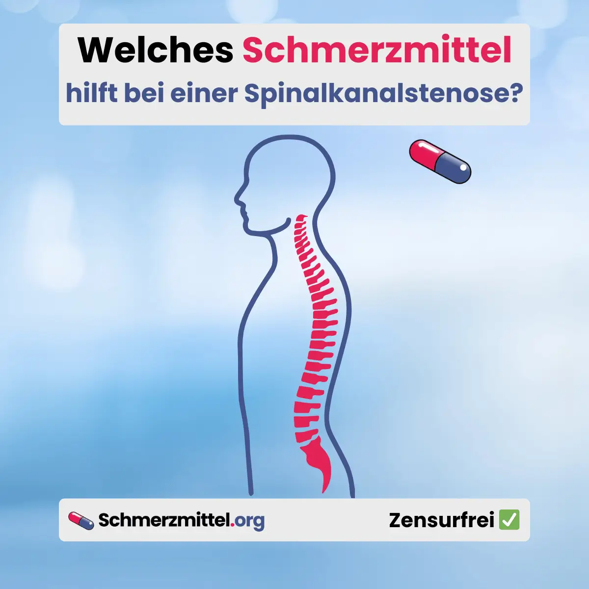 Welches Schmerzmittel bei eier Spinalkanalstenose