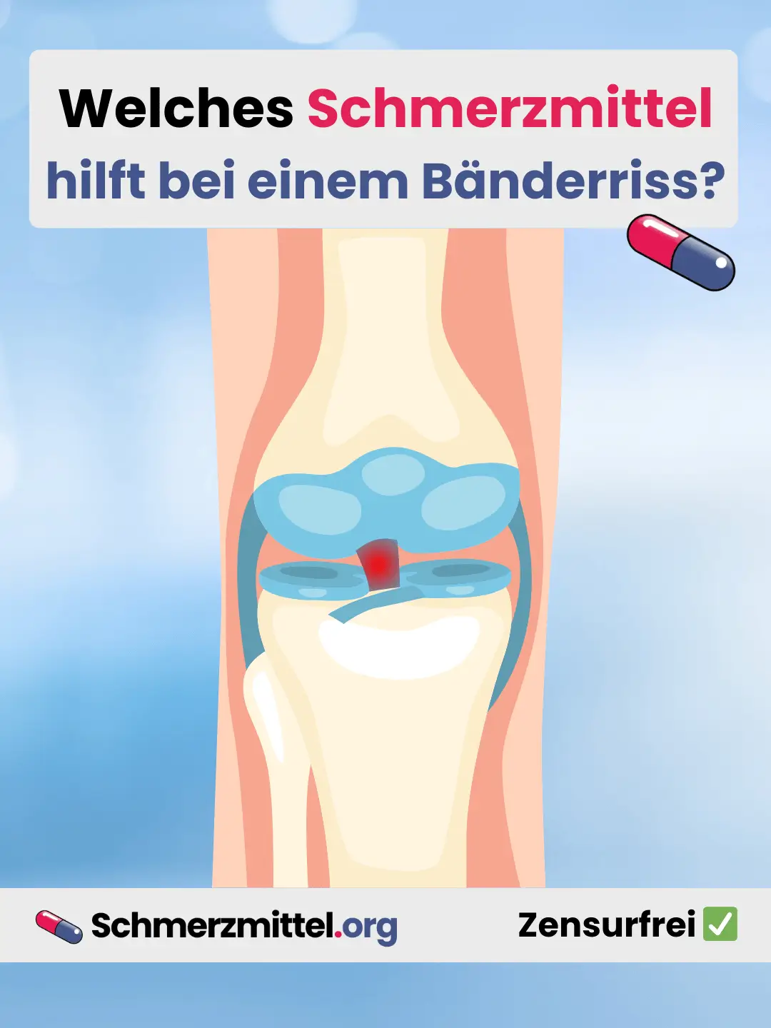 Welches Schmerzmittel bei einem bänderriss Teilen