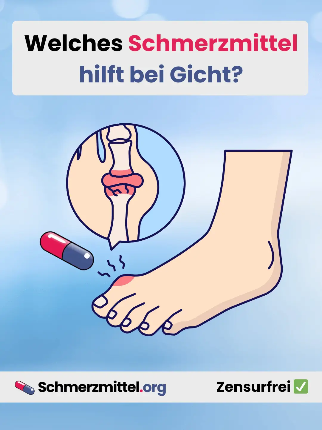 Welches Schmerzmittel bei gicht Teilen