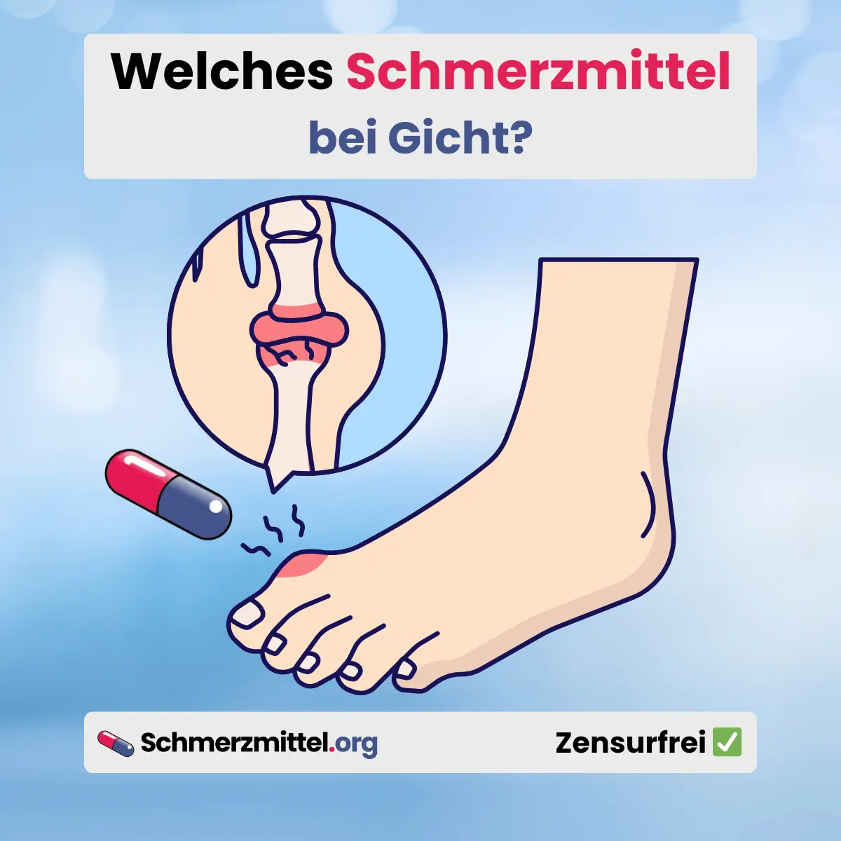 Welches Schmerzmittel bei gicht schmerzen