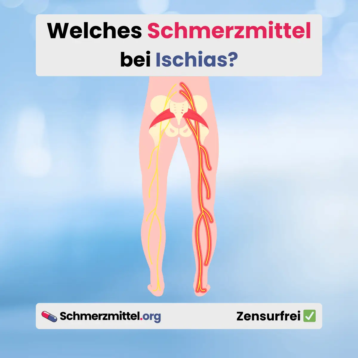 Welches Schmerzmittel bei ischias