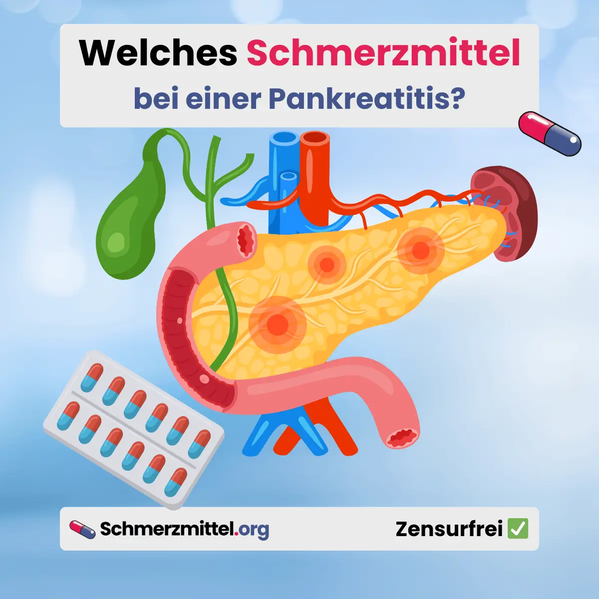 Bauchspeicheldrüsenentzündung Welches Schmerzmittel bei Pankreatitis