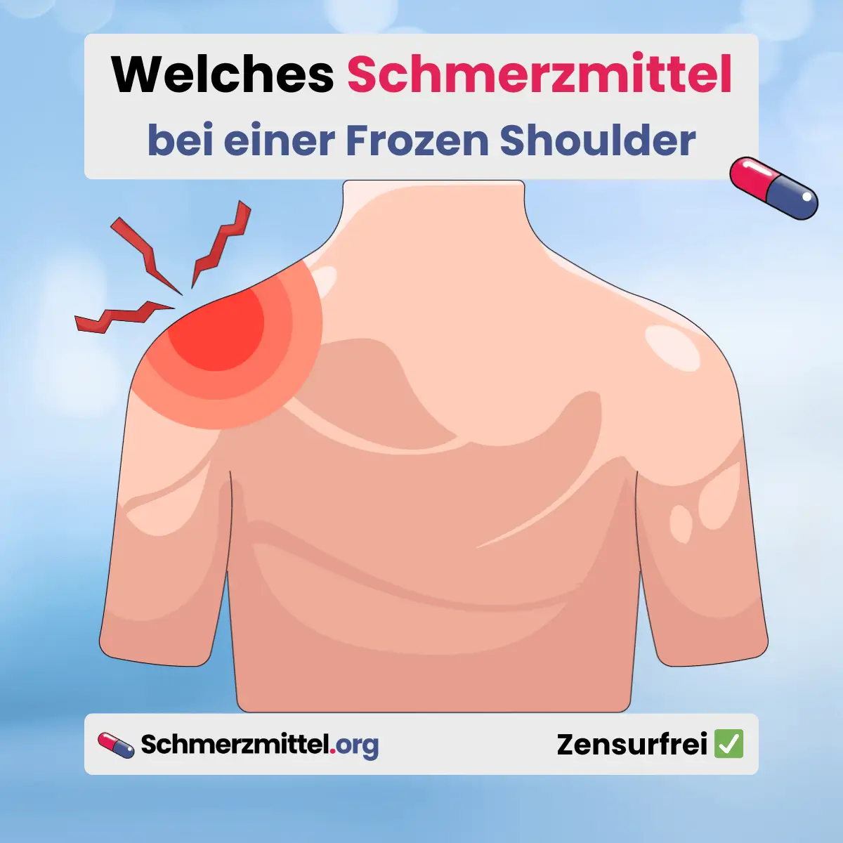 Eingefrorene Schulter Welches Schmerzmittel bei frozen shoulder