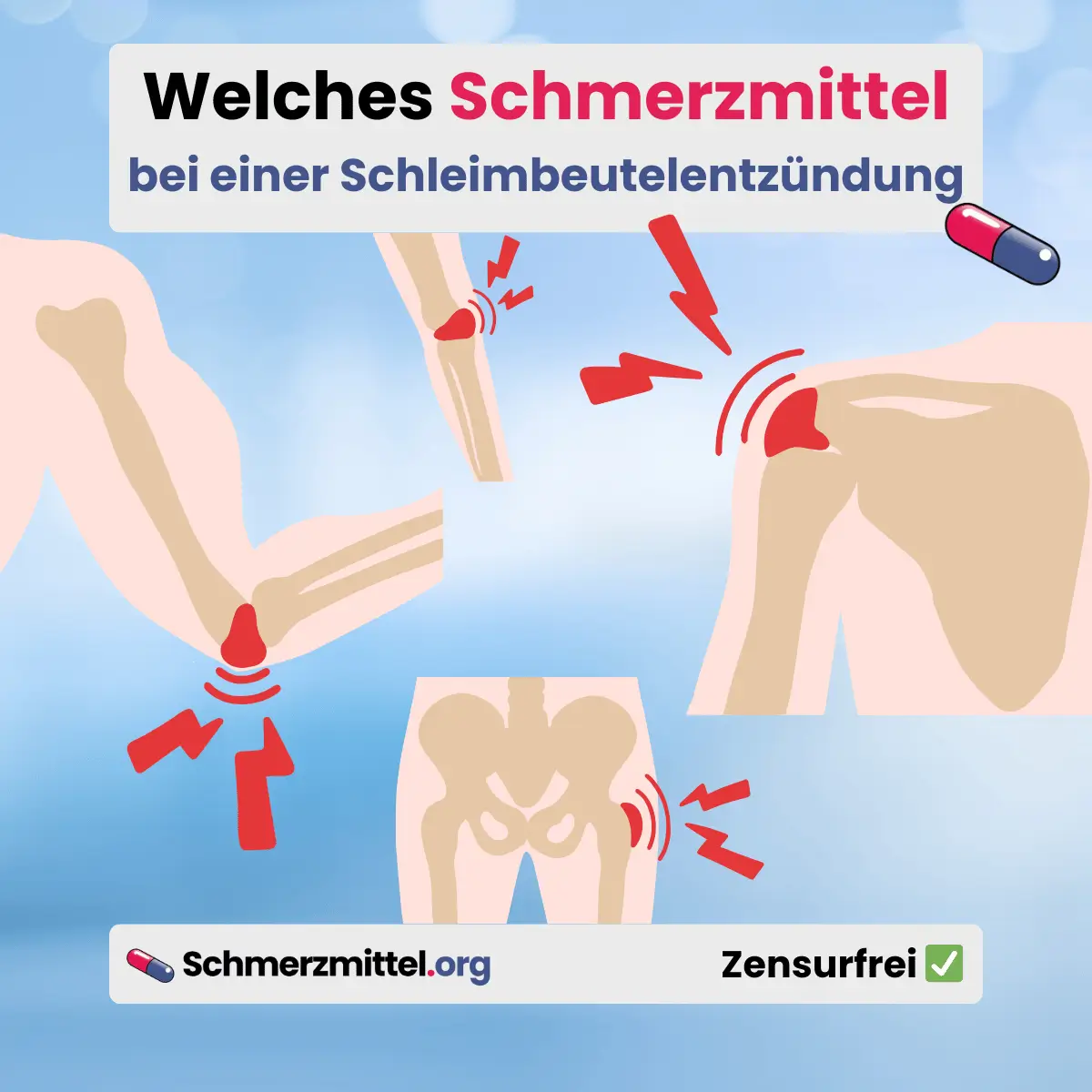Entzündeter Schleimbeutel Welches Schmerzmittel bei Bursitis