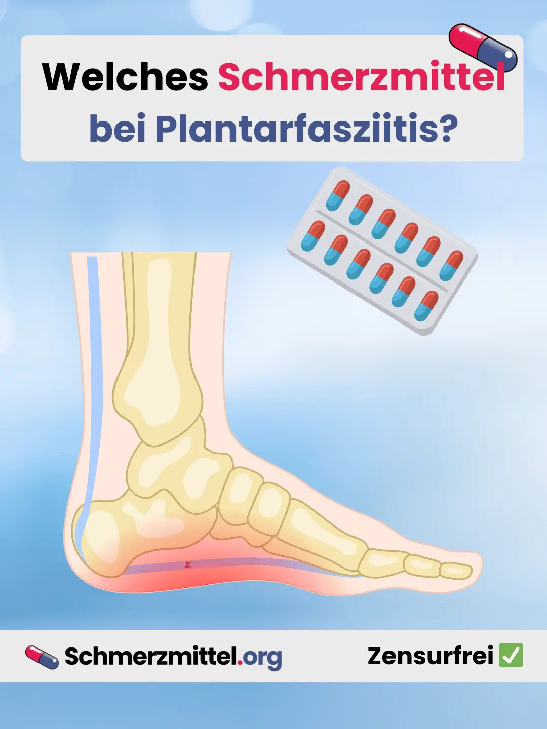 Fersenschmerzen Welches Schmerzmittel bei Plantarfasziitis Schmerzen Teilen