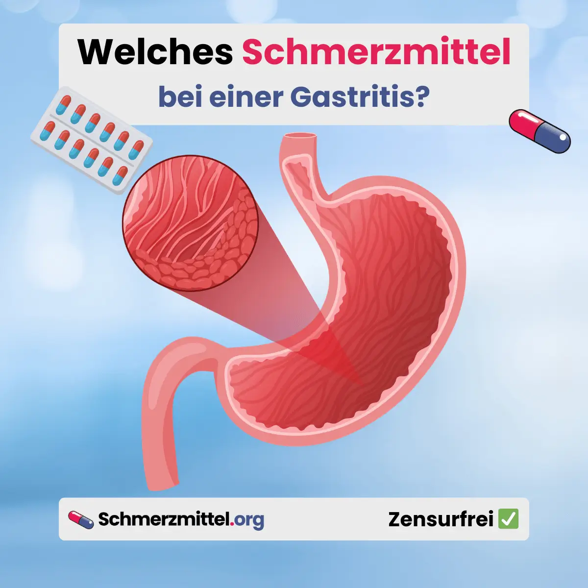 Magenschleimhautentzündung Schmerzmittel bei Gastritis