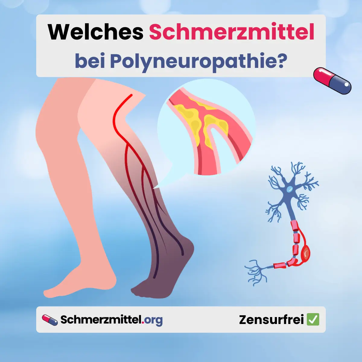 Nervenschädigung Nervenschmerzen Welches Schmerzmittel bei Polyneuropathie