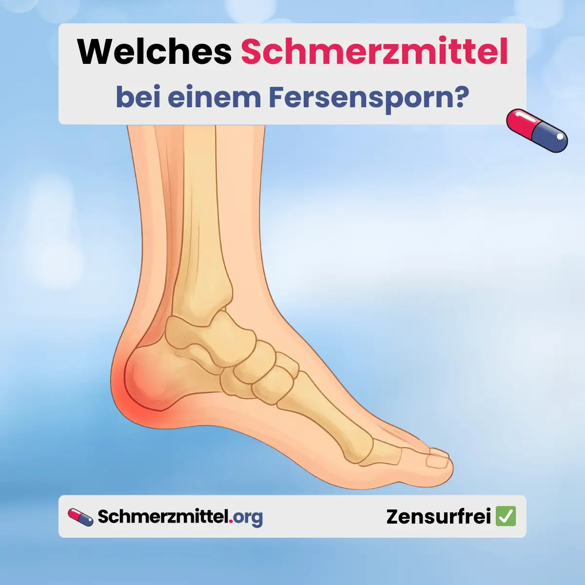 Schmerzmittel bei Fersensporn liste warum fersen schmerz