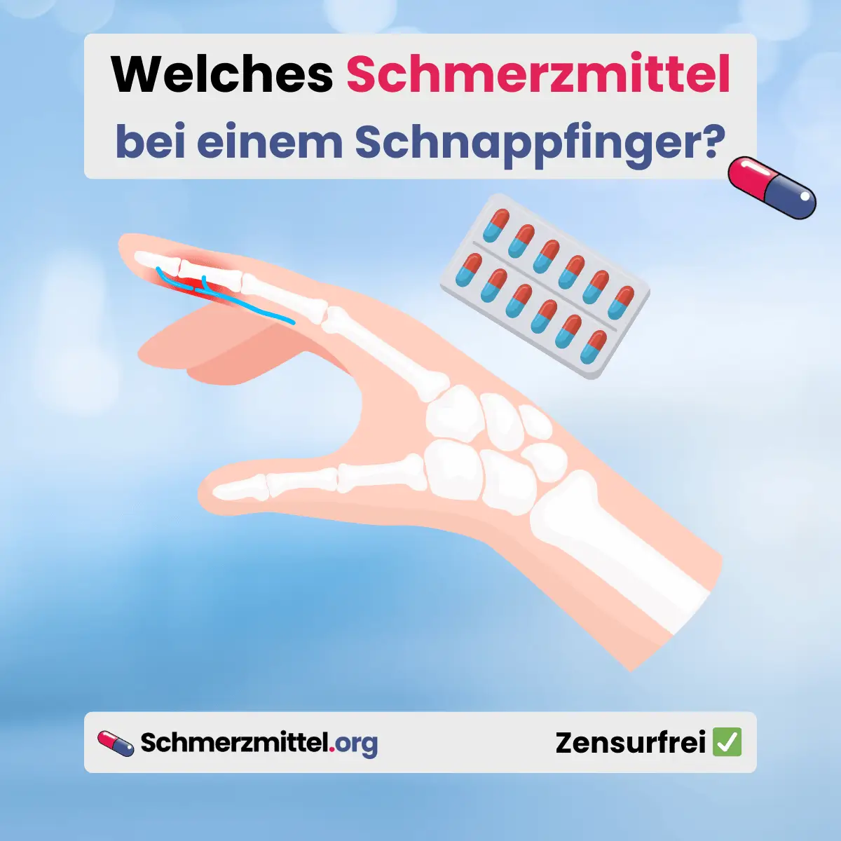 Schnellender Finger - Welches Schmerzmittel bei Schnappfinger