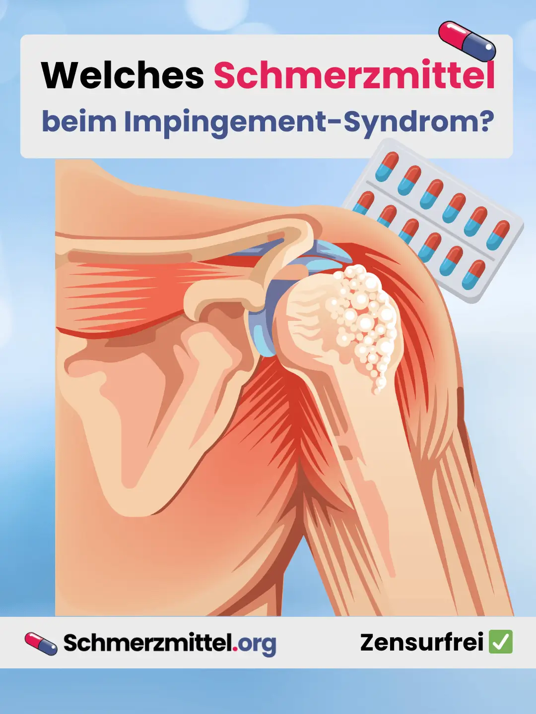 Schulterengpass Schmerzmittel bei Impingement Schulter Schmerzen Teilen