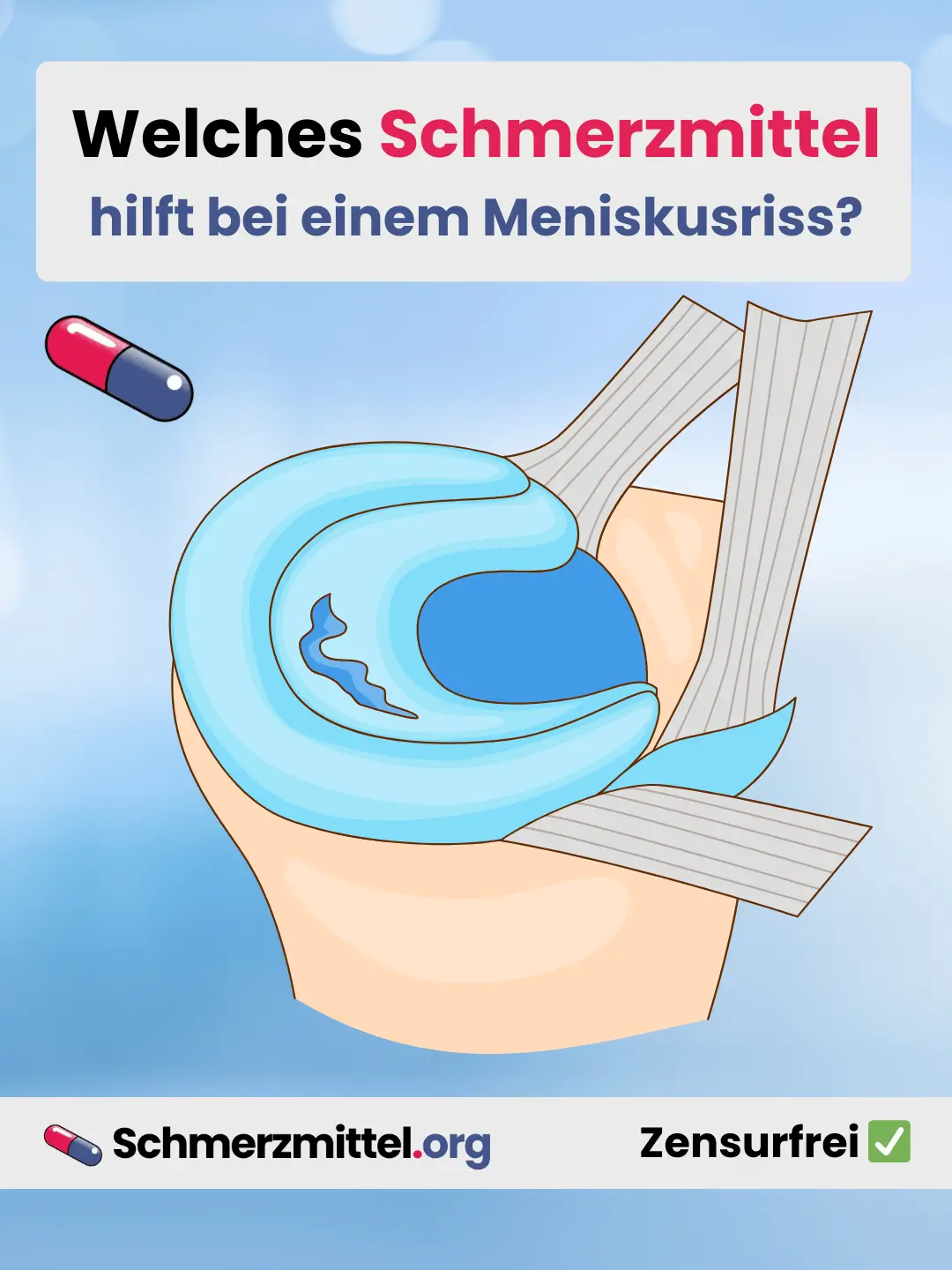 Welches Schmerzmittel bei Meniskusriss Teilen