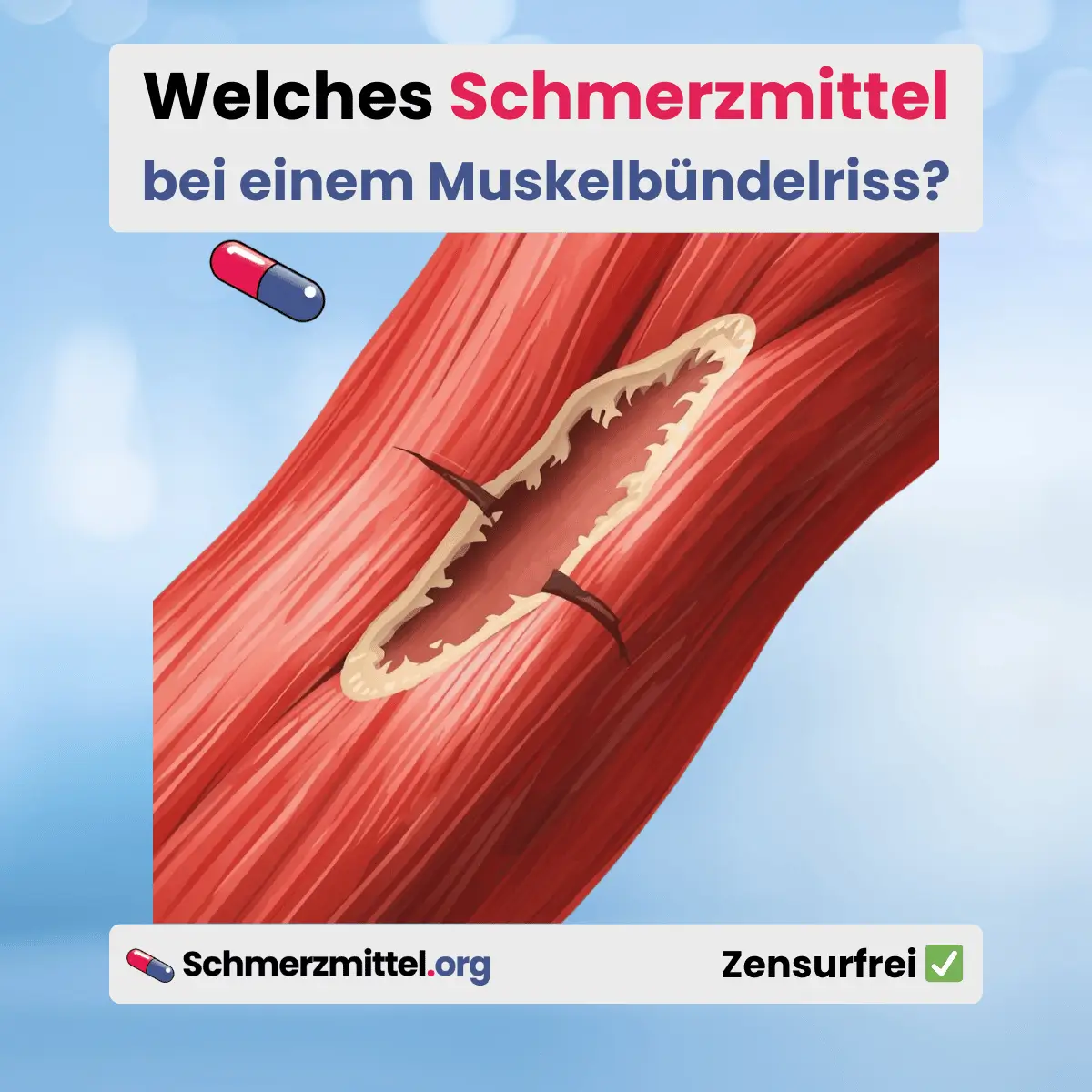 Welches Schmerzmittel bei Muskelbündelriss