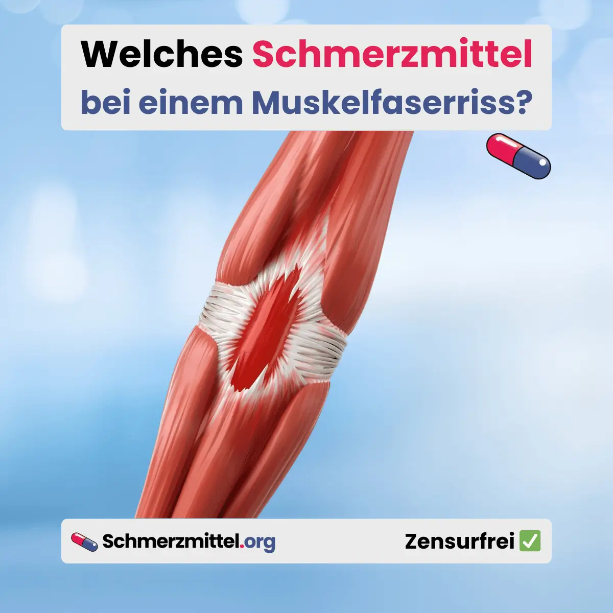 Welches Schmerzmittel bei Muskelfaserriss