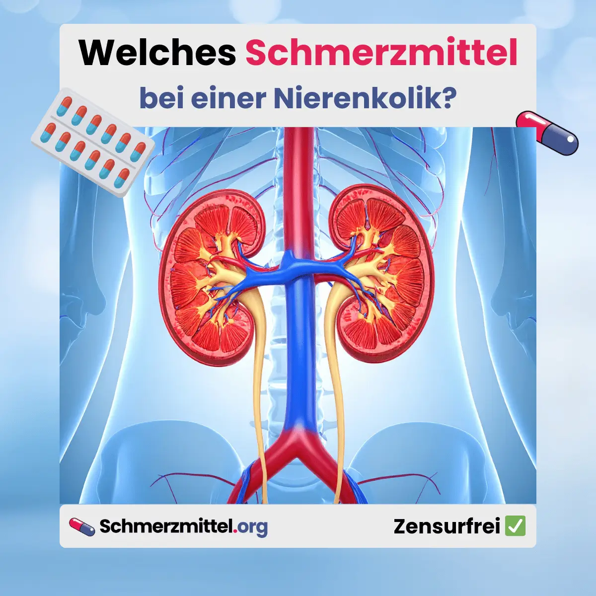 Welches Schmerzmittel bei Nierenkolik