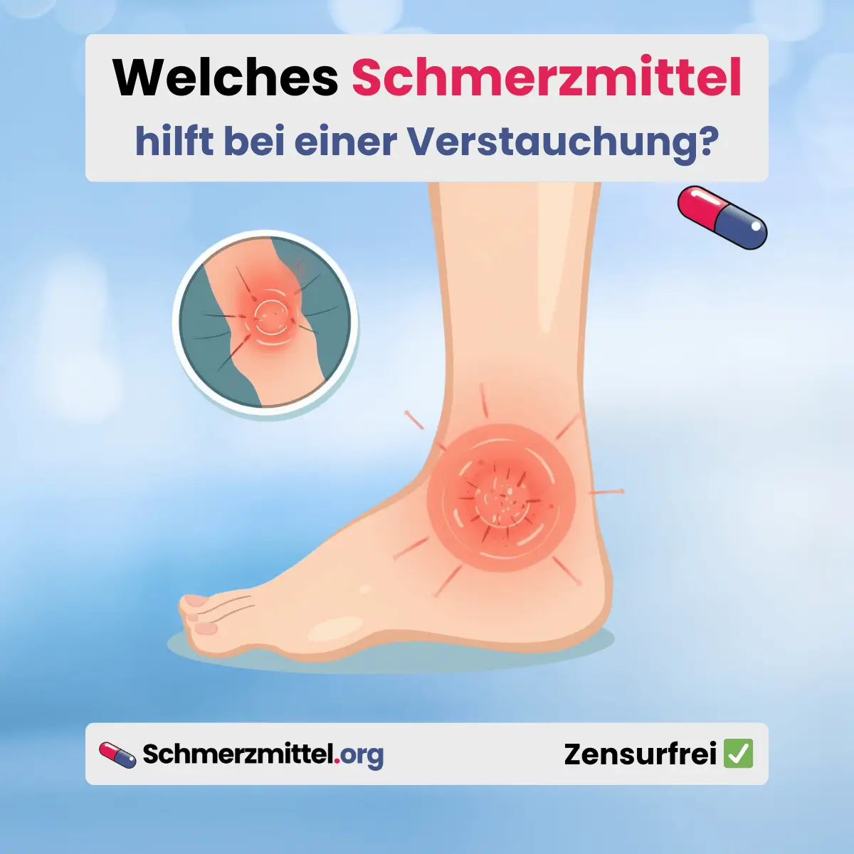Welches Schmerzmittel bei einer verstauchung