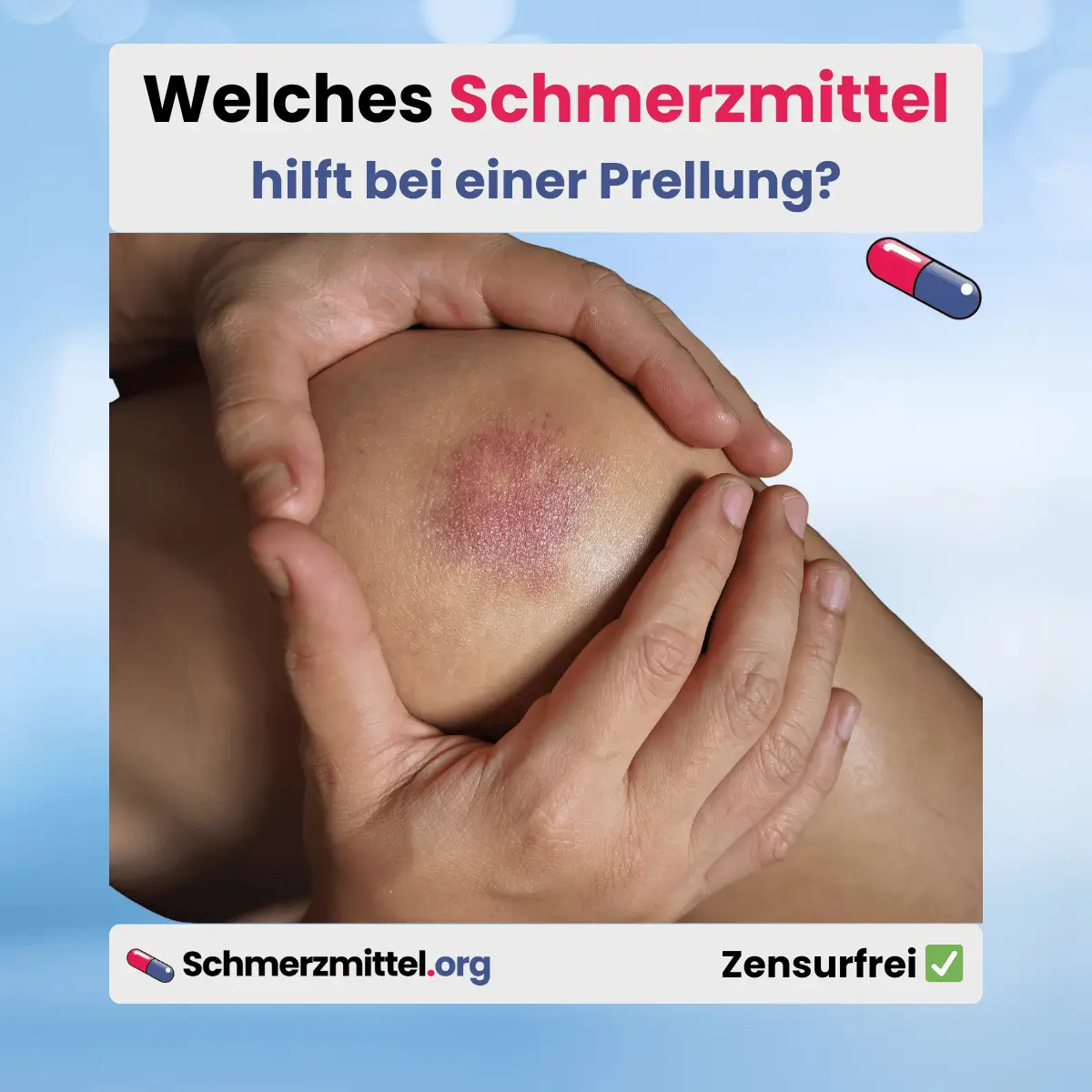 Welches Schmerzmittel bei prellung