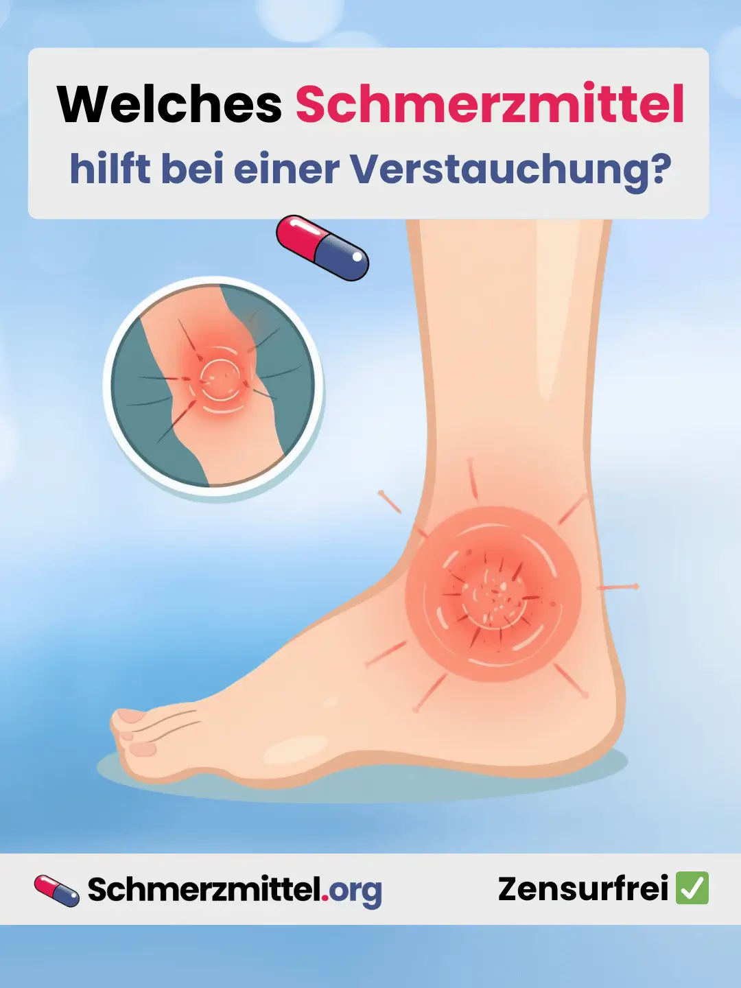 Welches Schmerzmittel bei verstauchung schmerzen Teilen