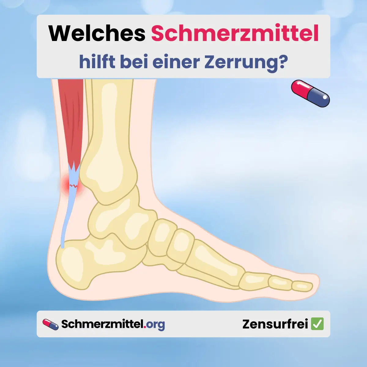 Welches Schmerzmittel bei zerrung muskelzerrung