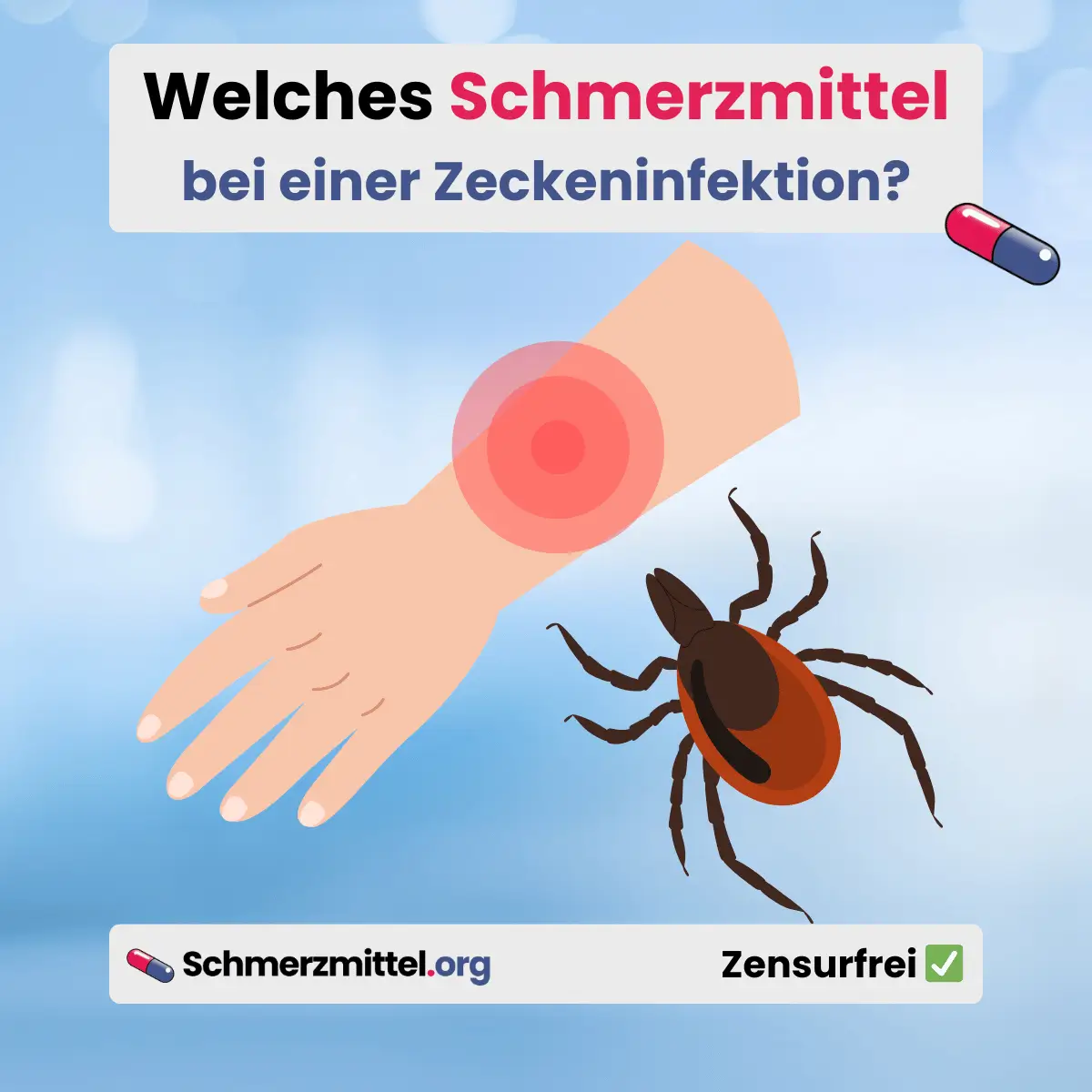 Zeckeninfektion Welches Schmerzmittel bei Borreliose