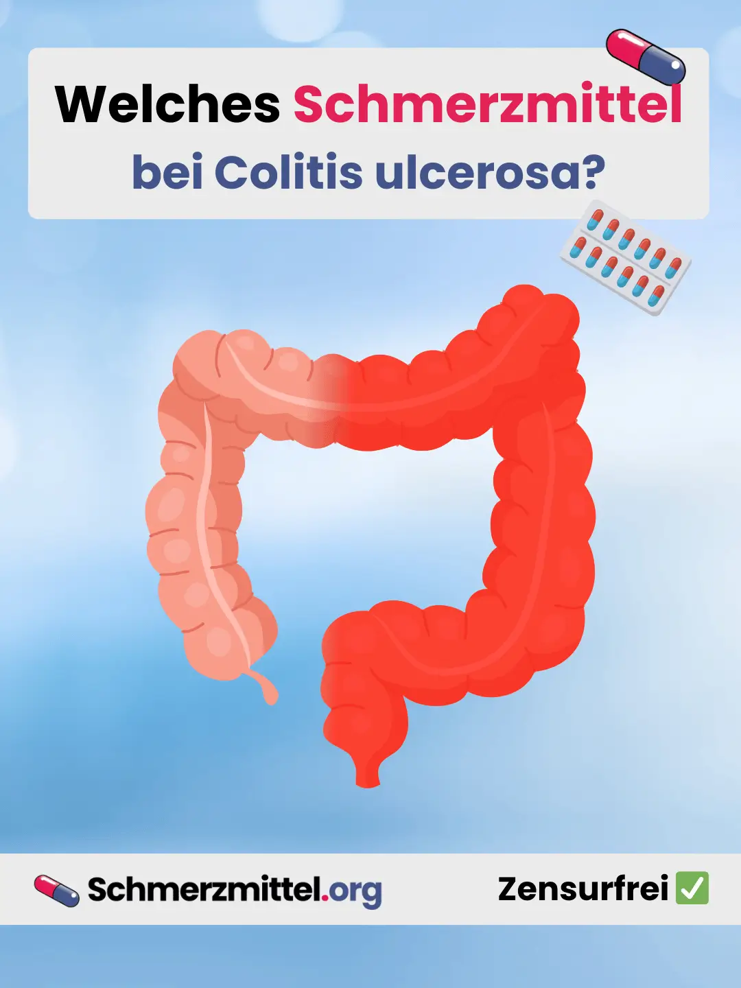 chronische Darmentzündung Welches Schmerzmittel bei Colitis ulcerosa Teilen