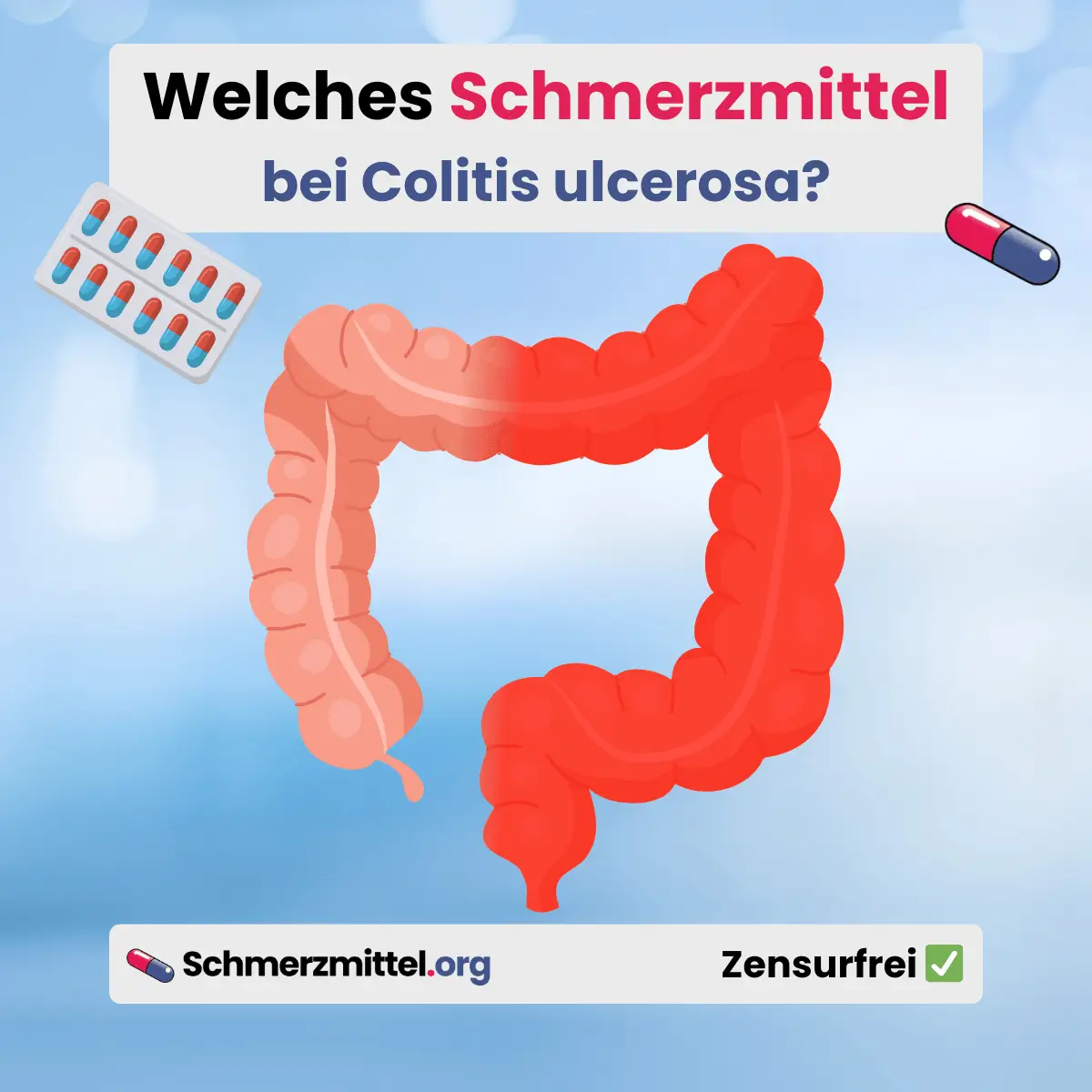 chronische Darmentzündung Welches Schmerzmittel bei Colitis ulcerosa