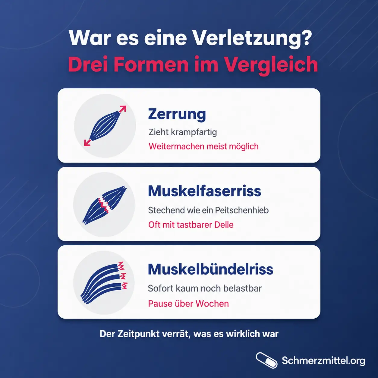 Unterschied zwischen Zerrung, Muskelfaserriss und Muskelbündelriss bei plötzlichem Muskelschmerz