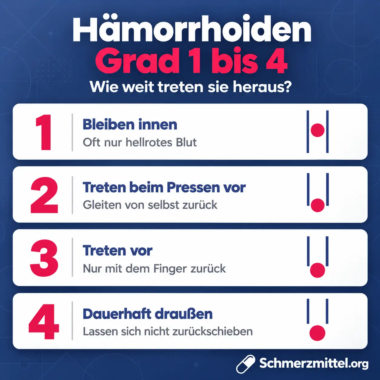 Hämorrhoiden Grad 1 bis 4, Grad 1 bleiben innen mit hellrotem Blut, Grad 2 treten beim Pressen vor und gleiten zurück, Grad 3 nur mit dem Finger zurück, Grad 4 dauerhaft draußen
