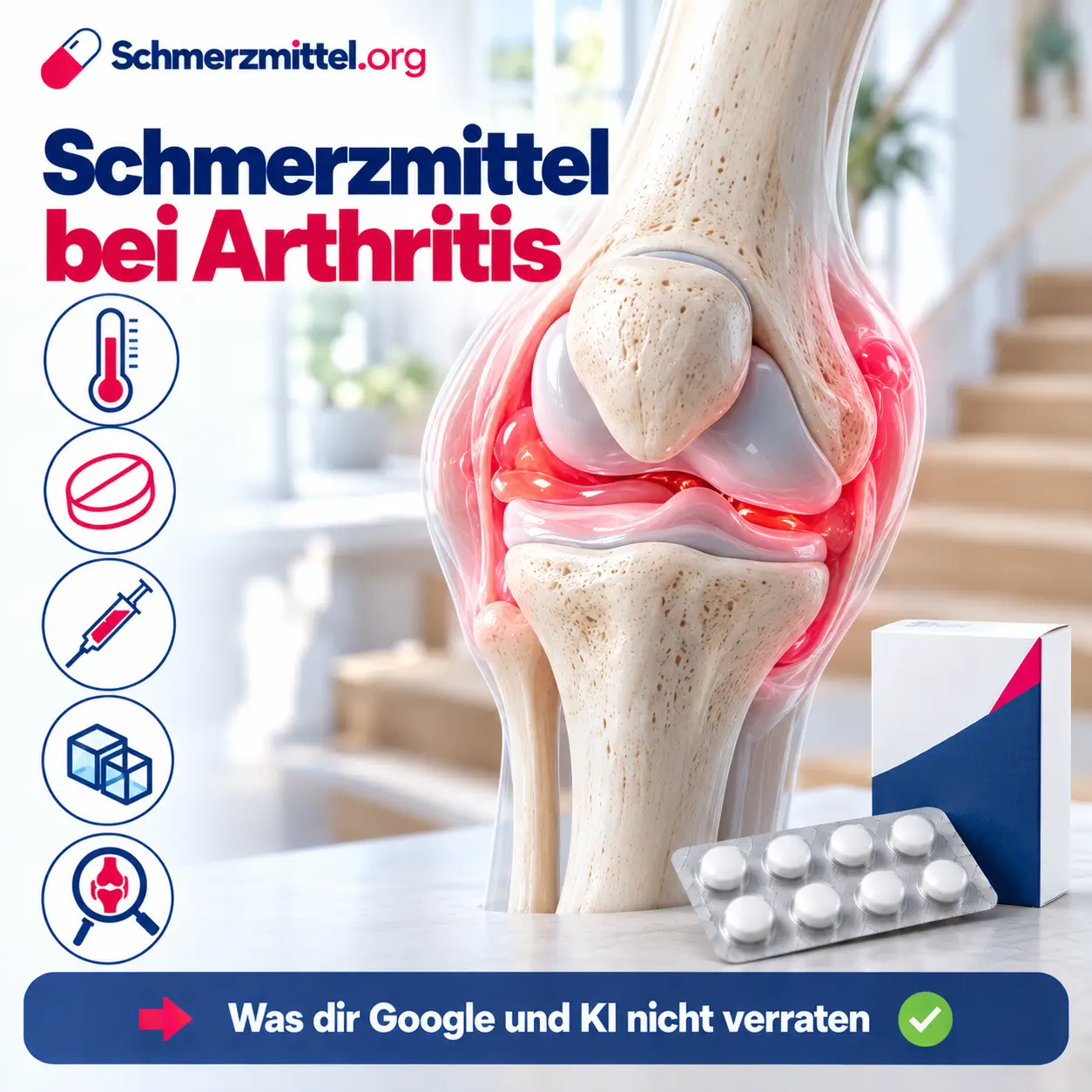 Schmerzmittel bei Arthritis, 3D-Modell eines Kniegelenks mit aufgeblähter rot leuchtender Gelenkkapsel vor einem hellen Treppenhaus, davor eine Medikamentenpackung, Icons zu Fieber, Entzündungshemmern, Kortison-Spritze, Kühlen und Ursachensuche