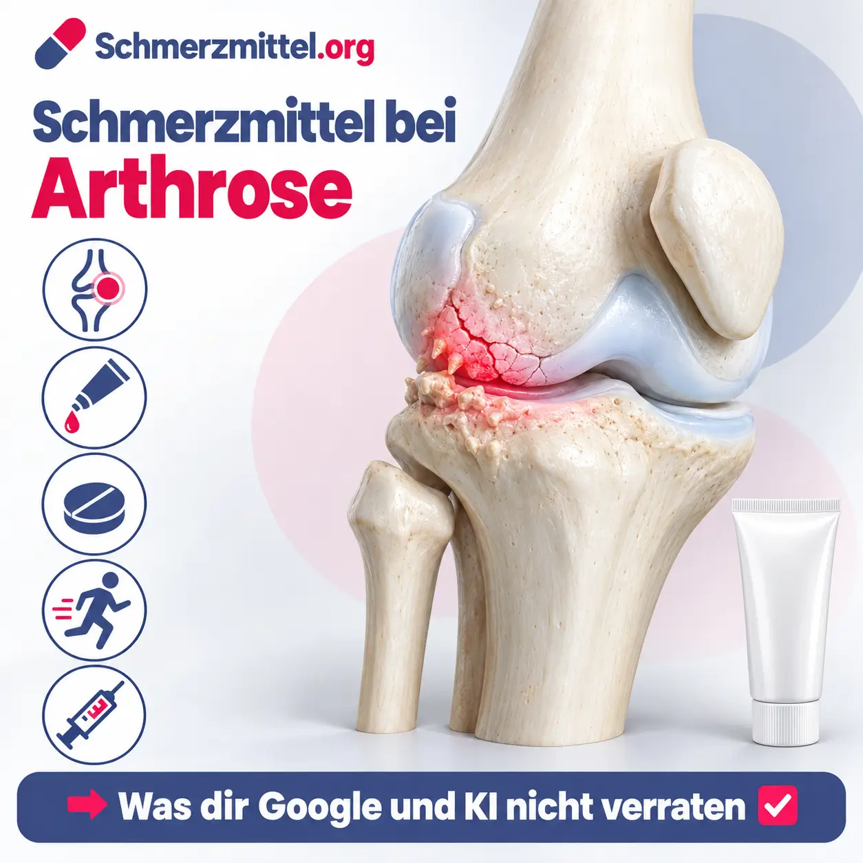 Schmerzmittel bei Arthrose, 3D-Modell eines Kniegelenks mit ausgedünntem Knorpel und rot leuchtender Abnutzung an der Gelenkinnenseite, daneben Schmerzgel und Medikamentenpackung, Icons zu Arthrose, Schmerzgel, Tabletten, Bewegung und Kortisonspritze