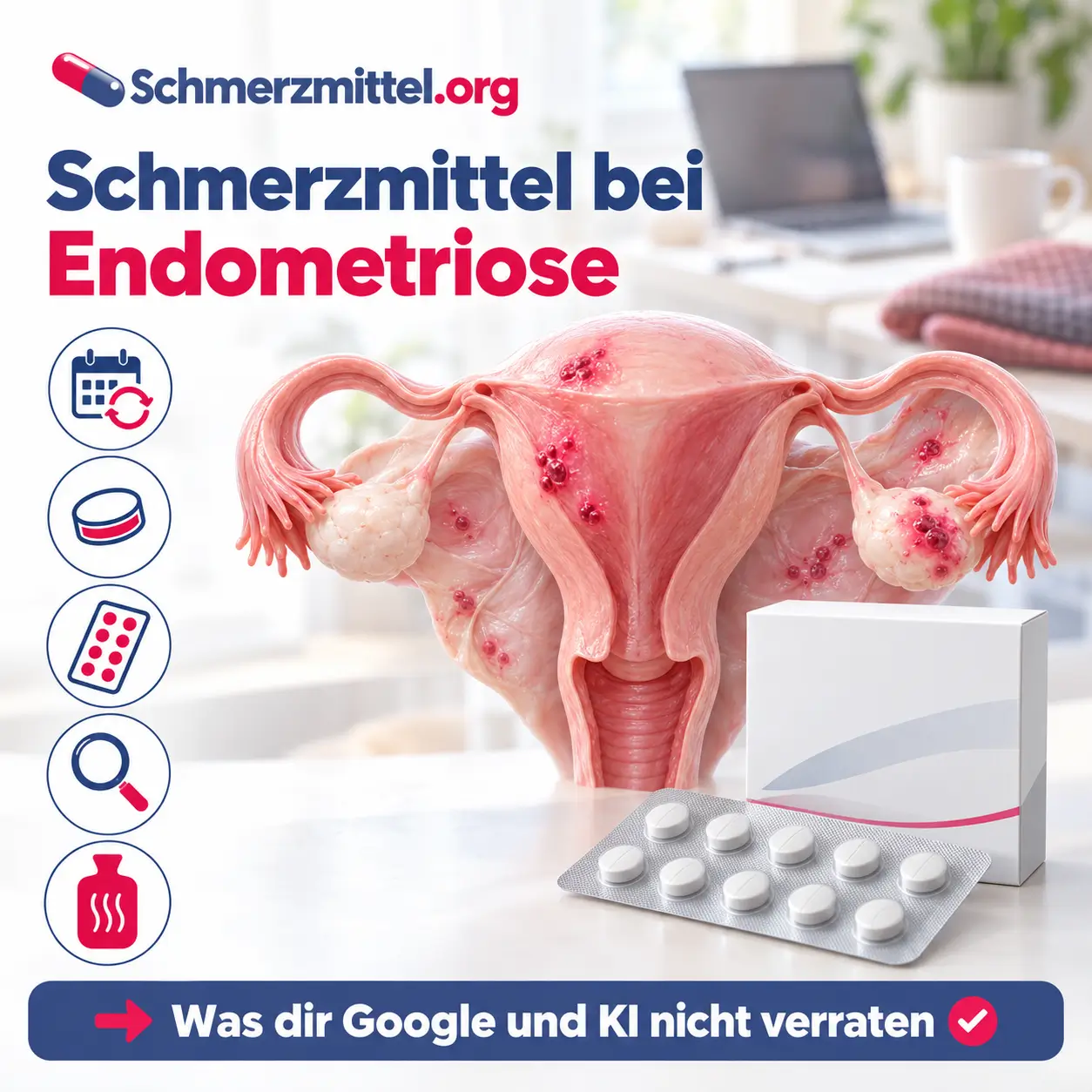 Schmerzmittel bei Endometriose, 3D-Modell von Gebärmutter, Eileitern und Eierstöcken mit rot leuchtenden Endometrioseherden vor einem Arbeitsplatz zu Hause, davor eine Medikamentenpackung, Icons zu Zyklus, Tablette, Hormontherapie, Diagnose und Wärme