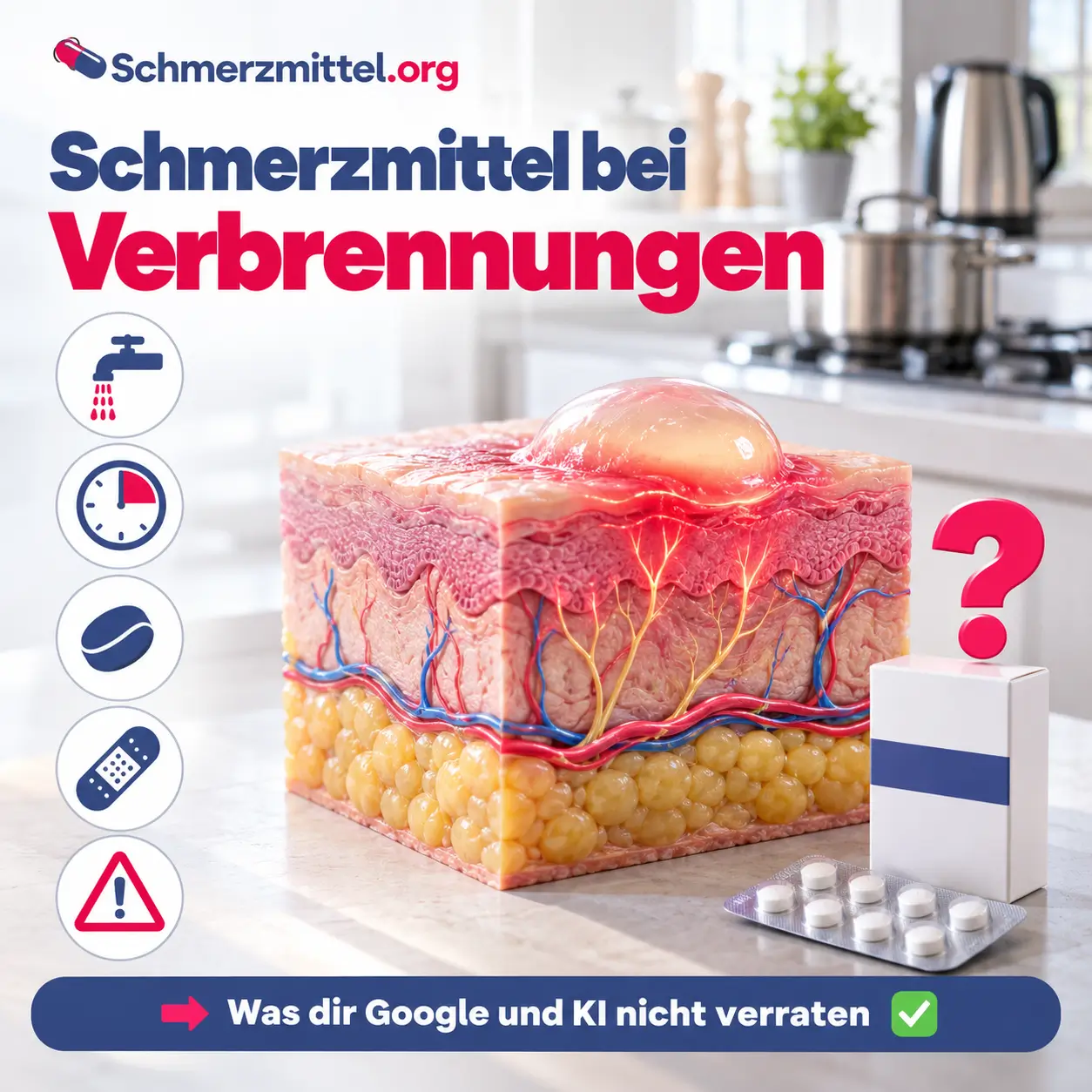 Schmerzmittel bei Verbrennungen, 3D-Modell eines Hautquerschnitts mit Brandblase und rot leuchtender Oberhaut und Lederhaut vor einer Küche, davor eine neutrale Medikamentenpackung mit pinkem Fragezeichen