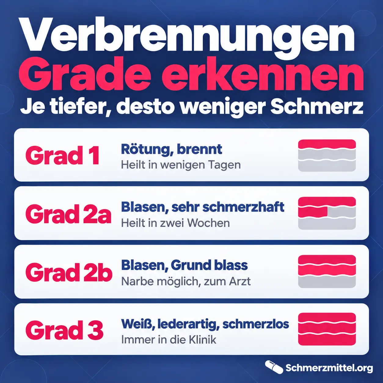 Verbrennungen Grade erkennen, Grad 1 Rötung heilt in wenigen Tagen, Grad 2a Blasen sehr schmerzhaft heilt in zwei Wochen, Grad 2b Blasen mit blassem Grund Narbe möglich, Grad 3 weiß lederartig schmerzlos immer in die Klinik